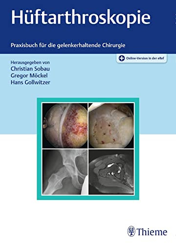 Hüftarthroskopie: Praxisbuch für die gelenkerhaltende Chirurgie
