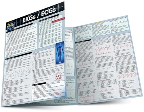 EKGs / ECGs: a QuickStudy Laminated Reference Guide