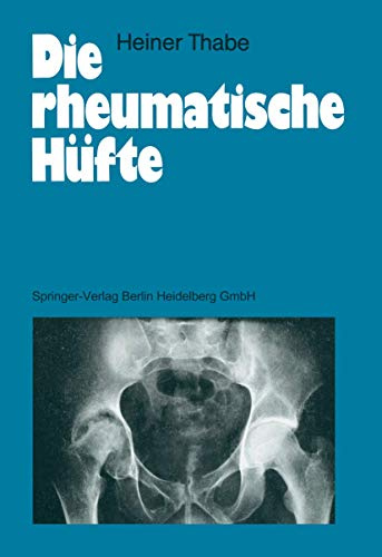 Die rheumatische Hüfte (German Edition)