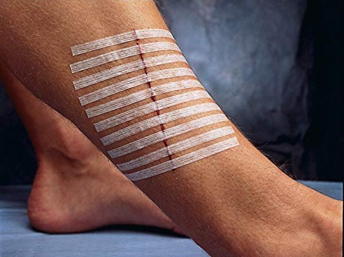 3M Steri-Strip, Wundverschlussstreifen, verstärkt, 3 x 75 mm, 10 Stück