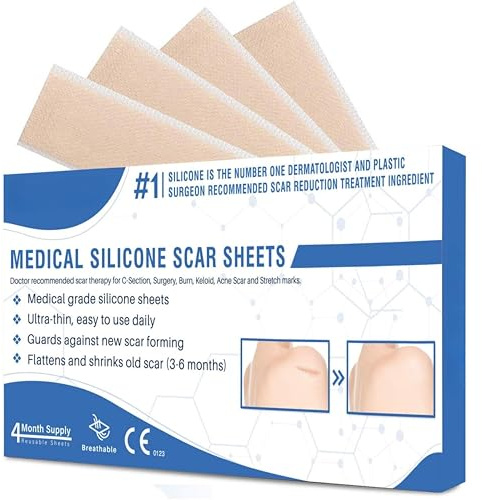 Zoff Adhesive Remover Wipes – Powerful Sticky Residue Cleaner for Labels, Stickers, Glue & More – Safe for Surfaces, Easy to Use, 20 Wipes/Pack – Ideal for Homes, Offices & Crafts – Pack of 2