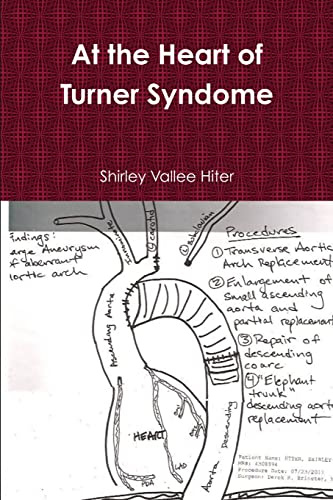 At The Heart of Turner Syndrome
