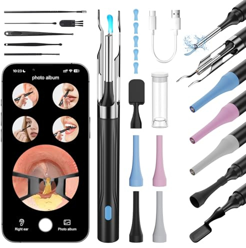 6 in 1 Kamerawerkzeug zur Ohrenschmalzentfernung mit Pinzette, Ear Scope Otoskop Set mit 6 LED Kameralichtern, visueller Ohrpicker, kabelloser Ohrenschmalzentferner (schwarz, DF004)