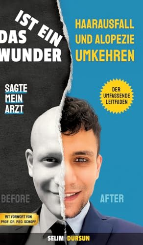 DAS IST EIN WUNDER SAGTE MEIN ARZT: HAARVERLUST UND ALOPEZIE UMKEHREN