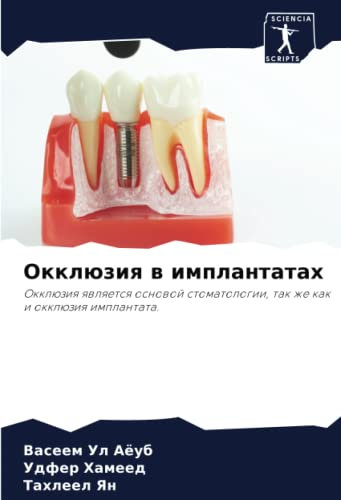 Окклюзия в имплантатах: Окклюзия является основой стоматологии, так же как и окклюзия имплантата.: Okklüziq qwlqetsq osnowoj stomatologii, tak zhe kak i okklüziq implantata.