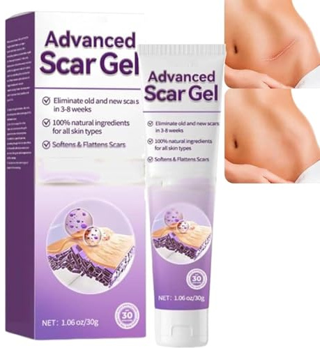 BOVROTIN Advanced Scar Gel, professionelle Narbenentfernungscreme, Silikon-Narbengel, Intensive Narbencreme, für Verbrennungen, Akne, Dehnungsstreifen