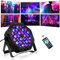 BrightWish Disco Lights for Parties, 36 LED Stage Lights with DMX & Remote Control, 7 Mode RGB Effect for DJ Events, Kids Party, Club, Bar, Home Birthday
