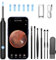 LMECHN Ear Wax Removal, Ear Cleaner with Camera, Ear Wax Removal Kit with 1080P, Ear Camera Otoscope with LED Light, Ear Cleaning Kit for iPhone, iPad, Android Phones-Black