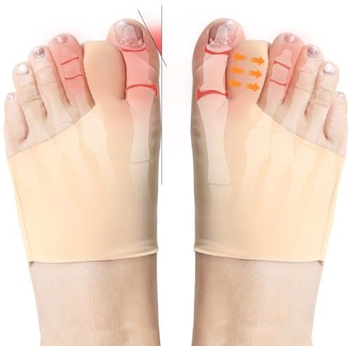 Cevikno 1 par hallux valgus korrigering hallux valgus skena, tåspridare hallux valgus hallux valgus valgus strumpor för smärtlindring inbyggd avtagbar silikon stötdämpare