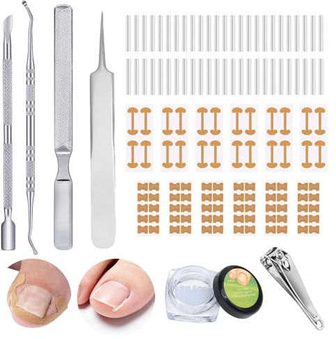 Ylinwtech 139 pieza juego de uñas encarnadas,Corrector de uñas,Kit de herramientas con cortaúñas,Apto para el cuidado de los pies