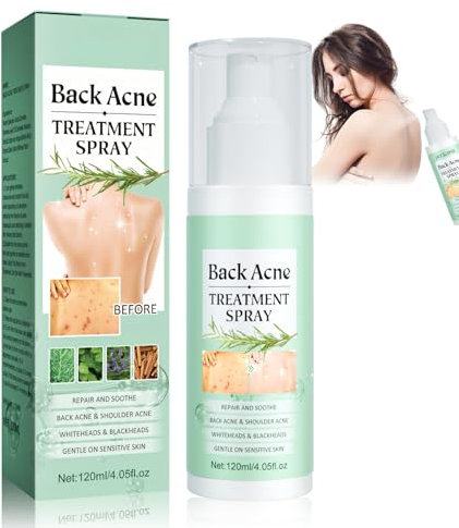Acné Dos, Traitement de l'acné Corporelle, Spray de Traitement de l'acné pour le Dos, Spray Nettoyant pour l'acné du dos, Nettoyage en Profondeur de l'acné du Corps, Votre Peau Plus Lisse, 120ml