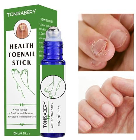 Cracked Toenail Repair | Health Toenail Stick Roller,0.3fl Oz Natural Soothing Softening, Healthy Cuticle Oil Rollerball Strengthens Nails & Protects Cuticles