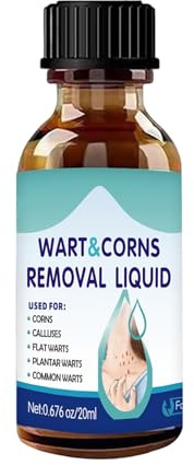 Rimozione Nei Della Pelle Per Il Corpo - Soluzione Liquida 20ml,Trattamento Nei | Per Viso Collo Schiena Spalle Mani Braccia Gambe Piedi Casa Viaggio