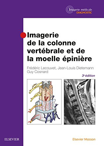Imagerie De La Colonne Vertébrale Et De La Moelle Épinière