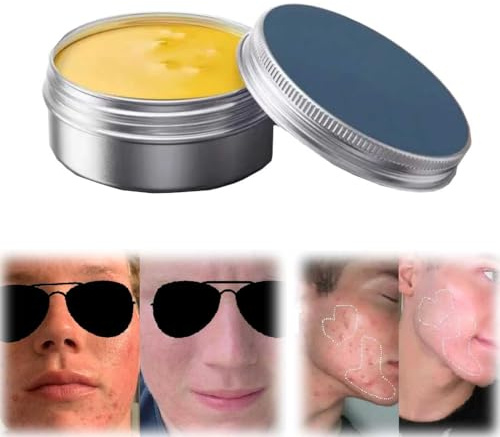 Kit De Soins De La Peau Anti-Acné Et Rougeurs,Formule Naturelle Et Douce,CrèMe Anti-Acné Pour Adolescents Et Adultes,Baume Anti-Acné Pour Tous Les Types De Peau (1 pièce)