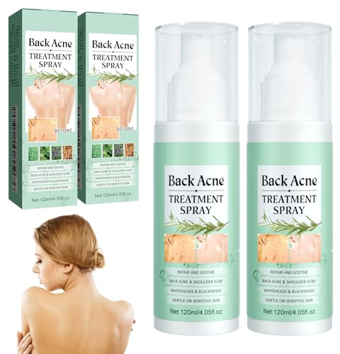Akne Rücken Spray, 2 Stück Rücken Back Acne Spray, Gegen Pickel Rücken, Rücken-Peeling Tiefenreinigung, Akne-Behandlungsspray für Körper, Brust und Rücken, Behandlung von Rückenakne, Sanft zur Haut