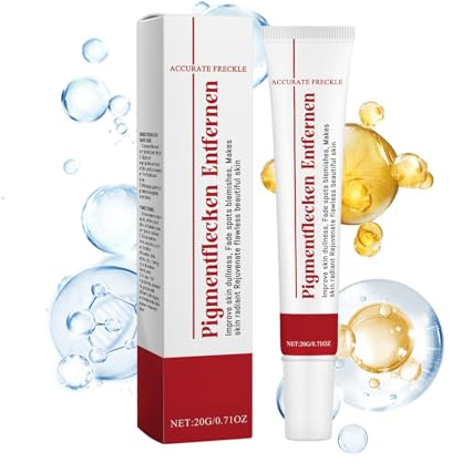 Crema per la rimozione di macchie di pigmento, anti macchie di pigmento, viso con niacinamide, vitamina C, crema anti-invecchiamento per le donne per macchie di età, lentiggini, Glow Skin (20 g)