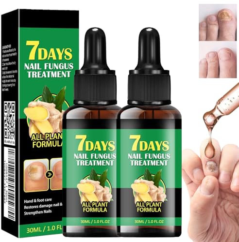 Ginger Nail Treatment, 7Day Nail fungus Treatment, Nail Support Nail Care, Ginger Nail Growth Treatment Serum, Ginger Cuticle Care Oil for Nails, Nail Strengthener Oil For Damaged Nails (2 Pcs)