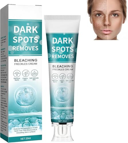 Crema di Melasma,Siero Luminoso per Correzione Macchies Scure,Crema Macchie Scure Viso,Anti Macchies Viso Cremas,Cremas Anti Macchie,20ML
