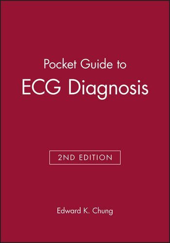 Pocket Guide to ECG Diagnosis by Edward K. Chung (2001-02-01)