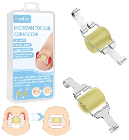 Corrector de uñas encarnadas InhwRior, fácil de usar en casa, estable y antideslizante, la tracción continua alivia rápidamente el dolor(19mm to 21mm Toenail Length)