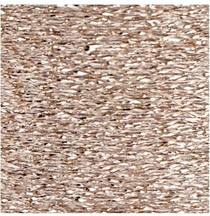 Rico Design Stickgarn - Metallicfarbe - Champagne