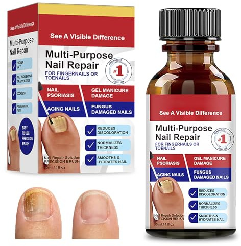 30ml Nagelpflege-Flüssigkeit für Fingernägel Und Fußnägel,Nagelhärter Zur Nagelstärkung,Nagelaufbauserum Repariert Splitternde Nägel für Gepflegte Hände,für Gleichmäßige Anwendung
