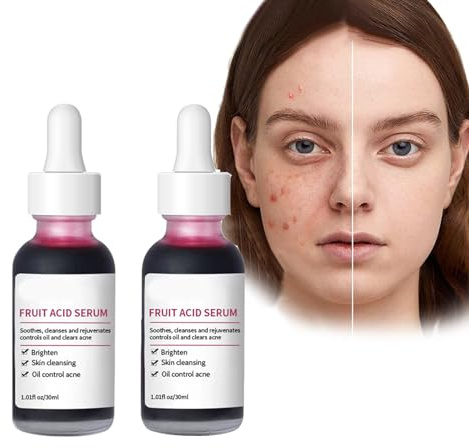 Pemarlis 2PCS Siero schiarente per rimuovere le macchie scure, olio siero correttivo per viso e corpo olio naturale sbiancante e schiarente per il trattamento della pelle con segni di acne e brufoli