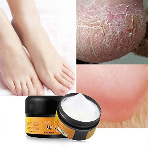 Allbestaye Foot Repair Skin Healing Cream for Thick Cracked Rough Dead Dry Skin, Moisturizing Callus Care for Feet Elbows Hands,Exfoliating Foot Cream for Cracked Heels and Dry Feet