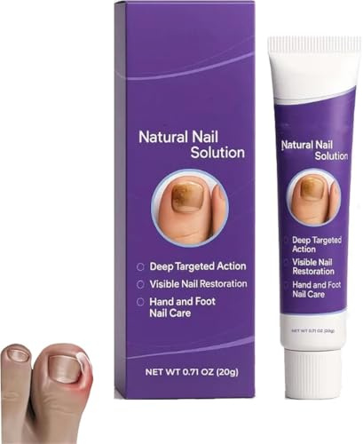 Solution naturelle contre les champignons des ongles, spray d'essence de réparation des ongles Timilk, spray de réparation avancé sans danger, ingrédients naturels, répare et revitalise les ongles