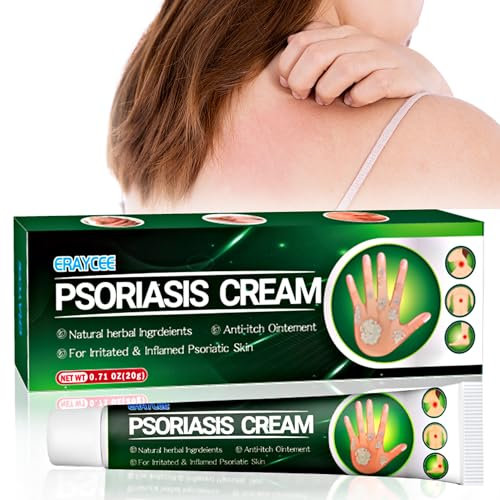 Crema antifungina 20 g, crema antifungina per la pelle allevia prurito, tigna, eczema, trattamento efficace di tinea pedis, allevia il prurito, lenisce le infezioni fungine sul corpo e sul viso