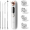 GlasFlength Aspiratore Punti Neri, Aspira Punti Neri con 4 Testine & 5 Modalità 65KPa Aspira Punti Neri Viso Vuoto Aspiratore Punti Neri Viso per Rimozione di Comedoni Brufoli Grasso Acne (Bianco)