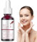 AHA 30% + BHA 2% Peeling Solution,Peeling-Lösung, Exfoliating Facial Serum, Gesichtsserum, Natürliches Gesichtspeeling Serum, um feine Linien und Falten zu Reduzieren (30ml)
