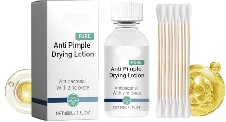 Akne-Spot-Behandlungscreme – Lässt Akne, Narben Und Poren Verblassen, Sanft For Alle Hauttypen, Einschließlich Empfindlicher Haut(2PCs)