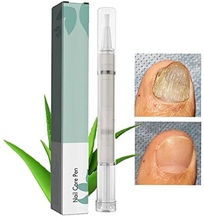 Nagelpflegestift, Fußpflege, Nagelreparaturstift, Nagelpilz-Behandlung für Zehen- und Fingernägel, Nagelwachstumsbehandlungsstift, Nagelhautöl für Nägel (1 Stück)