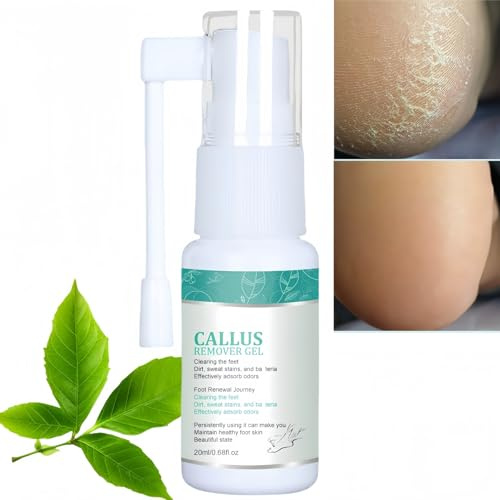 Callus Remover for Feet Gel with Urea,Hard Skin Remover Foot,Dead Skin Remover for Feet & Corn Removal,Foot Moisturiser with Urea Cream,Foot Care Gel for Women & Men,Includes Foot File,Effective