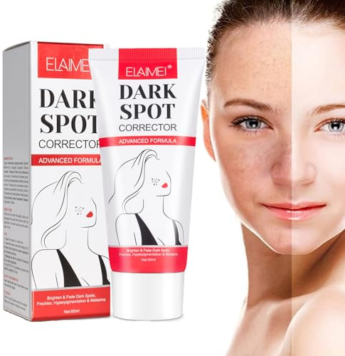 Anti Macchie Viso Crema, Crema Schiarente Macchie Viso, Dark Spot Corrector Remover, Utilizzato per Tono Della Pelle Irregolare, Rimozione Macchie Scure, Anti-melanina, Sbiancante e Schiarente-50ml