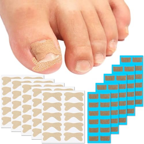 Aililong Set med inkarnerade nagelvård (110 stycken) – 60 x icke-filmplåster (fotkorrigering) + 50 st andningsbara självhäftande klistermärken för proffs
