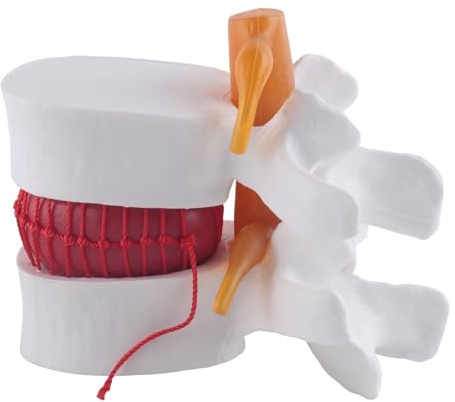 Okeeyseda Human Anatomia Scheletro Spinale Lombare Disco Insegnamento Modello Cervello Cranio Traumatico Materiale Scolastico Forniture Mediche