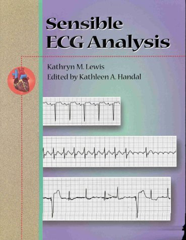 Sensible Ecg Analysis