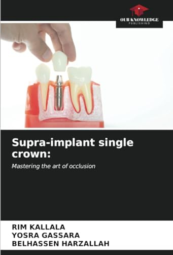 Supra-implant single crown:: Mastering the art of occlusion
