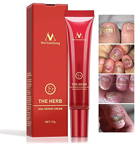 Crème pour les Ongles des Pieds aux Pieds, Protecteur Soins de la Peau Crème Onguent Traitement Ongle Onychomycose Paronychia Traitement Anti Fongique Crème de Réparation des Ongles, 15g