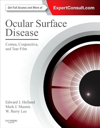Ocular Surface Disease: Cornea, Conjunctiva and Tear Film: Expert Consult - Online and Print