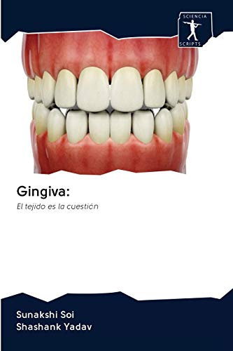 Gingiva:: El tejido es la cuestión