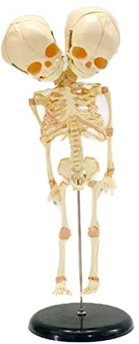 14,5 Zoll verformtes fetales Skelettmodell mit Doppelkopf – menschliches Skelettmodell – lebensgroßes medizinisches anatomisches Skelettmodell eines menschlichen fetalen Säuglings im Maßstab