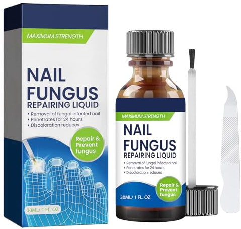 Fungal Nail Treatment, Extra Strong Nail Fungus Treatment For Toenail & Finger, Toe Fungus Treatment Nail Repair Growth Nail Softener for Thick Finger Nail 30ML