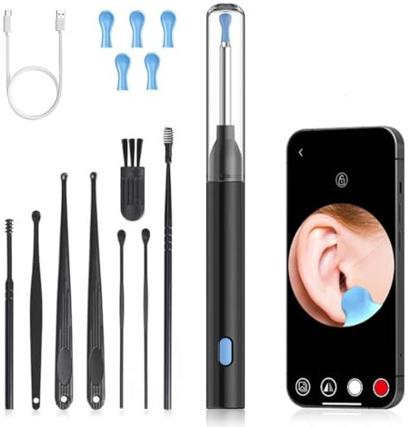 Ear Wax Removal Kit, Ohrenschmalz Entferner Otoskop, Wi-Fi Visible Ohrreiniger-Kit, Wifi Ohrreiniger mit kamera, 360°-Weitwinkel Otoskop Kamera mit LEDs für Erwachsene, Kinder (Schwarz)
