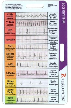 Carte de poche ECG/ECG, conception double face pour interprétation du rythme 'électrocardiogramme interprétation du rythme, résultats cardiaques courants