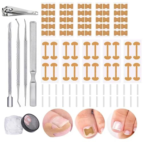 105 Pezzi Unghie Incarnite Kit, Professionali Unghia Incarnita Alluce Strisce Correttore, Cerotti Correttivi con Cerotti Traspiranti, per Pedicure e Cura delle Unghie
