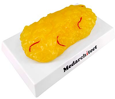 Authentic Human Body Fat Replica with Red Veins - 1 lb, Keep Fit & Weight Loss Motivation & Reminder, Human Fatty Tissue Demonstration Model for Nutritionist, Science Course for Medical Student